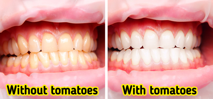 tomatoes benefits for teeth