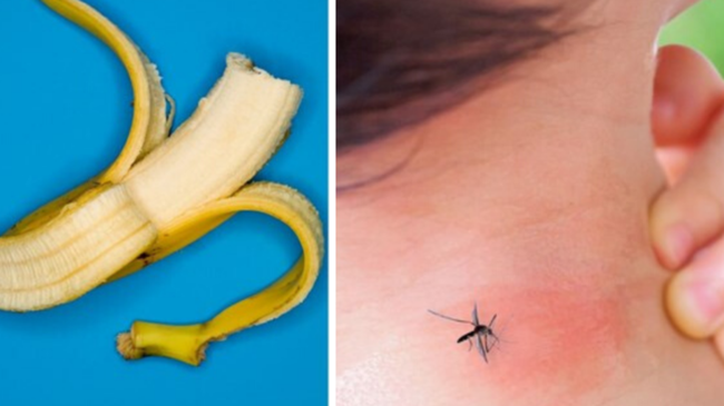 Mosquito bite remedy: How to treat annoying itch with banana trick | 7NEWS