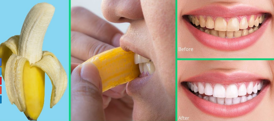 How to whiten the teeth using banana peels | Pulse Ghana